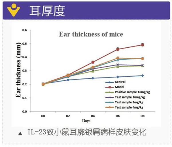 图6：耳厚度.jpg
