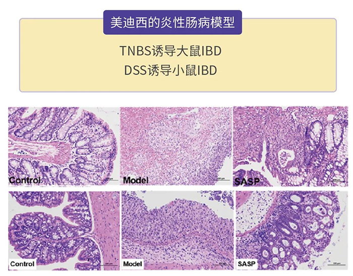 BOBSport的炎性肠病模型.png BOBSport的炎性肠病模型.png